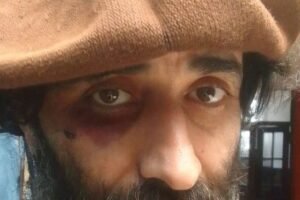 Asalto brutal en La Perla: víctima con heridas graves